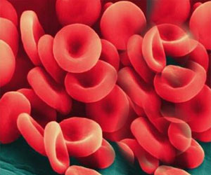   مصر اليوم - أنف صناعية قادرة على الكشف عن رائحة الجراثيم في الدم