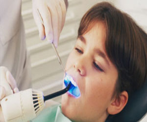 مصر اليوم - سوس الأسنان يقلل فرص الإصابة بسرطان الفم والحلق