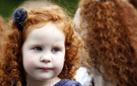   مصر اليوم - دراسة حديثة تضع خريطة جينية للشعر الأحمر في إنكلترا وأيرلندا