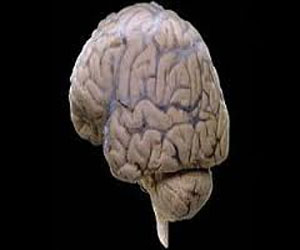   مصر اليوم - تصنيع مخ إنسانى مصغر في بيئة معملية