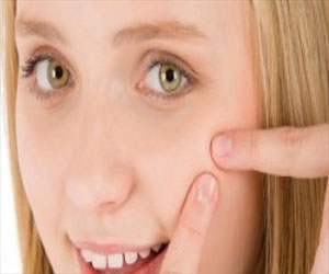 مصر اليوم - الليمون والبيض للتخلص من الرؤوس البيضاء والسوداء