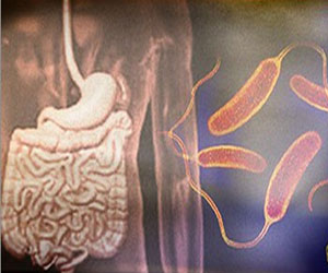   مصر اليوم - تنوع البكتيريا الموجوده في الأمعاء تحمي من الالتهابات المسببة لمرض السكر