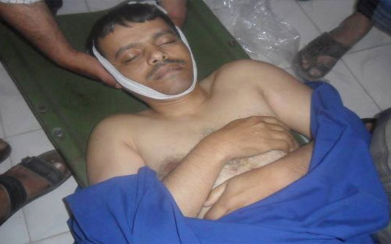   مصر اليوم - اضطرابات في مدينة تعز اليمنية بعد مقتل شقيق شيخ قبلي شمال البلاد