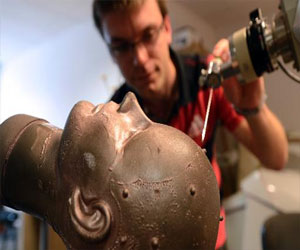   مصر اليوم - تحول جيني مرتبط بمرض الزهايمر يسرع تراجع وظائف الدماغ