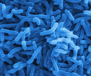   مصر اليوم - نيجيريا تحقق في مقتل وإصابة العشرات بالكوليرا