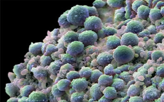 مصر اليوم - علماء يكتشفون عقارًا جديدًا لسرطان البروستاتا