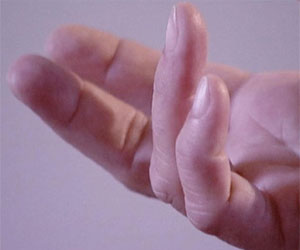   مصر اليوم - مرض تقوس الأصابع  الأسباب وطرق العلاج