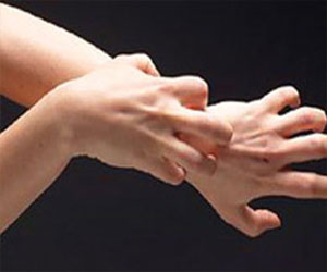   مصر اليوم - الحكة المزمنة قد تكون ناجمة عن ألم الخلايا العصبية