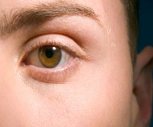   مصر اليوم - تعزيز دور البروتينات الواقية خير علاج بديل لإعتام العدسة