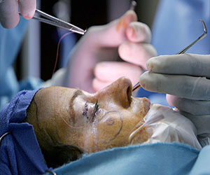   مصر اليوم - السجن سنة لجراح تجميل مزيف في الولايات المتحدة