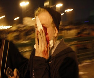   مصر اليوم - 6 إصابات حصيلة تظاهرات مؤيدي مرسي في القاهرة والدقهلية