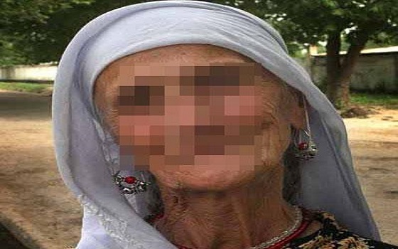 مصر اليوم - عجوز مغربيَّة في عقدها السَّابع تعيش دون معدة بعد استئصالها بسبب ورم خبيث