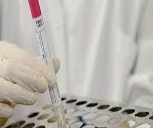   مصر اليوم - وزارة الصحة الفرنسية: لا توجد حالات إصابة جديدة بفيروس كورونا