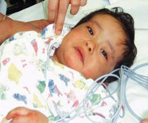   مصر اليوم - ظهور 3 إصابات جديدة بالغدة النكافية في قنا