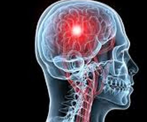   مصر اليوم - الفصام هلاوس وتوهم