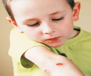   مصر اليوم - حركة إرادة قنا تطالب بتوفير العلاج لمرضى الهموفيليا