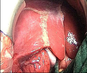   مصر اليوم - أسبانيا الأولي في التبرع بالأعضاء واستهلاك الكوكايين