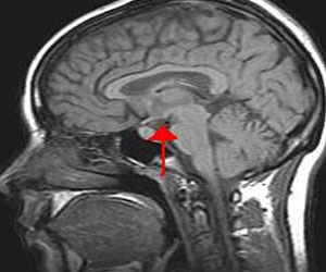   مصر اليوم - بحث: الدماغ البشري تقوم بتلوين الإشياء