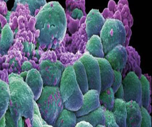   مصر اليوم - باحثون يجعلون خلايا السرطان تدمر نفسها دون إضرار الخلايا السليمة