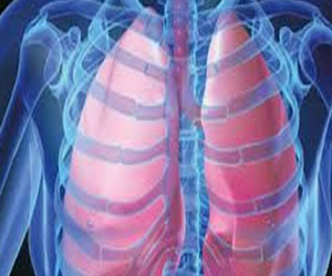   مصر اليوم - اليوم العالمي للألتهاب الرئوي