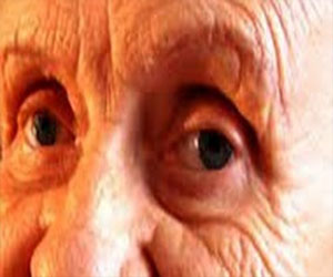   مصر اليوم - عدم وجود علاقة بين خرف الشيخوخة وأمراض العيون