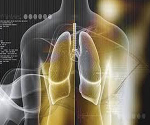   مصر اليوم - العالم يحتفل يوم 20 نوفمبر باليوم العالمي لمرضي الانسداد الرئوي