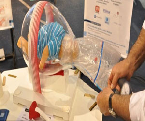   مصر اليوم - ميكانيكي سيَّارات يخترع جهازًا للولادة العسيرة