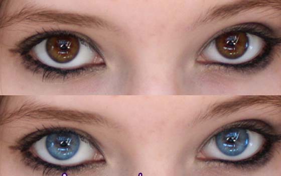   مصر اليوم - جرَّاح أميركي توصَّل الى طريقة لتغيير لون العين من دون عدسة