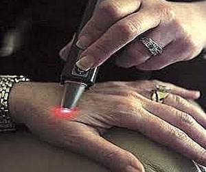   مصر اليوم - بدء أعمال المؤتمر العالمي للأمراض الجلدية والتناسلية والليزر في الكويت