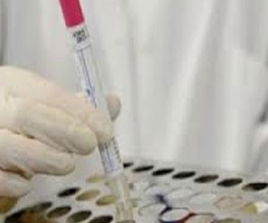 مصر اليوم - قطر تعلن شفاء مريض بفيروس كورونا ووفاة أخر