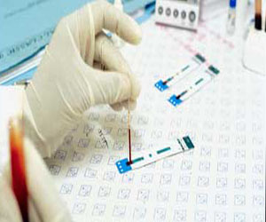   مصر اليوم - تراجع معدل الإصابة السنوى بالإيدز الى  26% فى آسيا