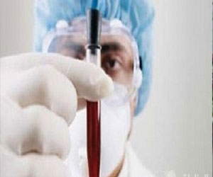   مصر اليوم - المجلس الأعلى للصحة القطري يعلن عن وفاة مقيم مصاب بفيروس كورونا