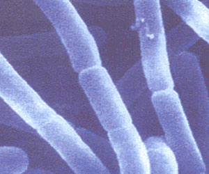   مصر اليوم - جبن من بكتيريا السرة والدموع والأنف