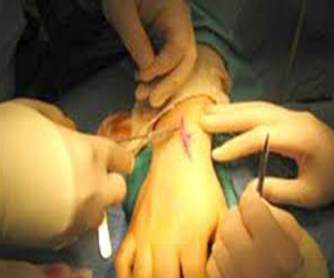   مصر اليوم - الغردقة تستضيف مؤتمر الجديد في جراحة اليد والجراحات الميكروسكوبية