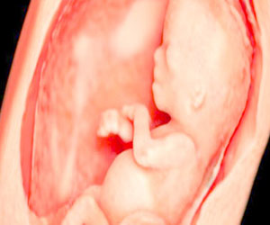   مصر اليوم - عملية ولادة ناجحة فى السويد لمريضة بالسرطان