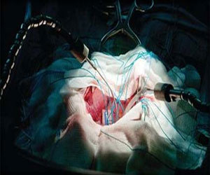   مصر اليوم - بدء أعمال المؤتمر الخليجي الرابع لجراحة المخ والاعصاب