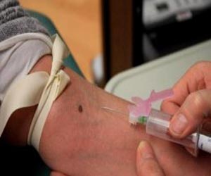   مصر اليوم - مرض السيدا لا زال يتسبب في وفيات في الجزائر بسبب التشخيص المتأخر