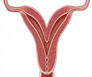   مصر اليوم - علاقة بين جاردازيل التطعيم ضد سرطان عنق الرحم وتجميد صفائح الدم