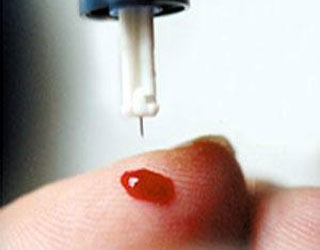 مصر اليوم - جهاز مطوّر يكشف خطر العدوى في دقائق