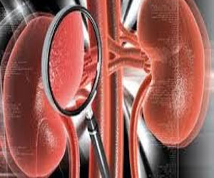   مصر اليوم - كلية طب سوهاج تنظم المؤتمر السنوى للجمعية المصرية لأمراض الكلى