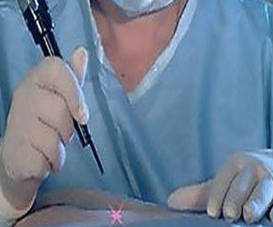   مصر اليوم - ألمانيا تحظر عمليات التجميل الاختيارية للأطفال والقاصرين