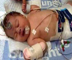   مصر اليوم - أطباء يجمدون مولودا لمدة 3 أيام في بريطانيا