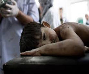   مصر اليوم - مسؤولون أمميون يدينون الاعتداء على المستشفيات والطواقم الطبية في سورية