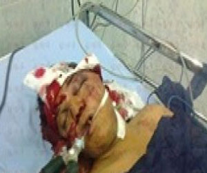   مصر اليوم - وفاة الناشط السياسي باسم محسن متأثرًا بإصابته