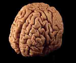   مصر اليوم - اكتشاف هرمون جديد يؤثر على القدرة على الحفظ وتذكر الوجوه