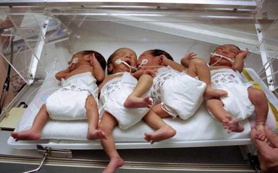   مصر اليوم - أمٌّ يمنيَّة تُنجب 4 أطفال توائم في تعز