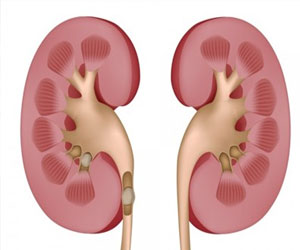   مصر اليوم - زيادة عدد المتبرعين بالكلي في هولندا عام 2013