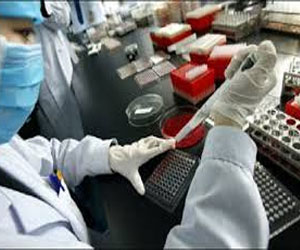   مصر اليوم - تسجيل أول حالة وفاة بأنفلونزا الطيور في كندا