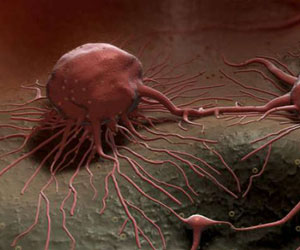   مصر اليوم - إعاقة بروتين MCL-1 تقضي على السرطان