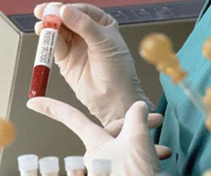   مصر اليوم - تحليل دم مطور للكشف المبكر عن سرطان القولون